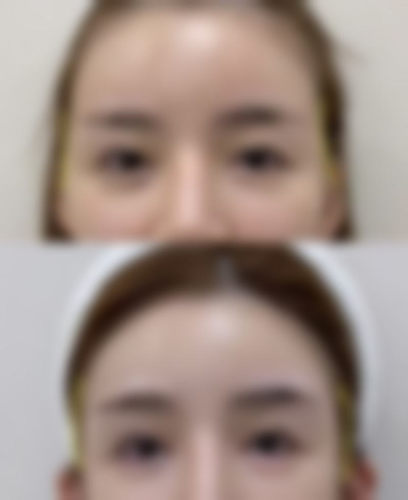 四、北京炫美医疗美容特色项目