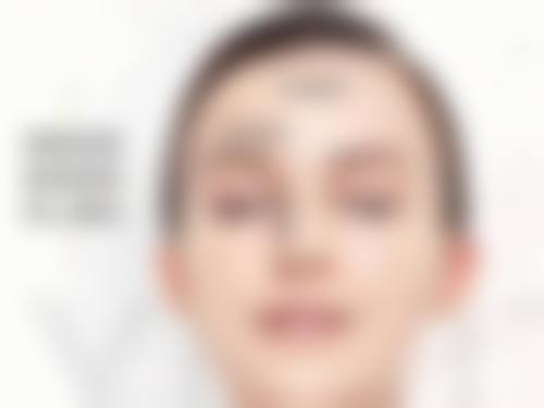 三、经常熬夜去眼袋之冷敷消肿