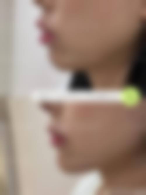 二、保定悦媛医疗美容医院怎么样?