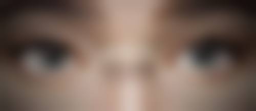 三、头发种植有后遗症吗之毛囊存活时间揭秘