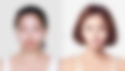 六、疤痕体质可以用药水点痣吗?总结