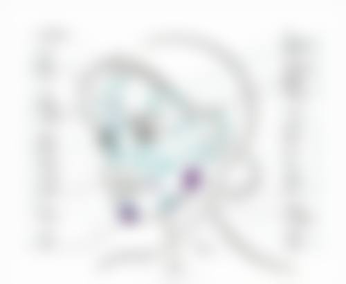 三、埋线双眼皮消肿的不同阶段表现