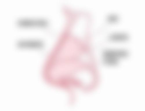 六、总结:埋线双眼皮需要多久消肿
