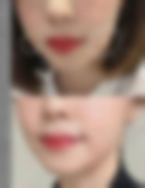 八、新乡名门医疗美容诊所真实的患者评价