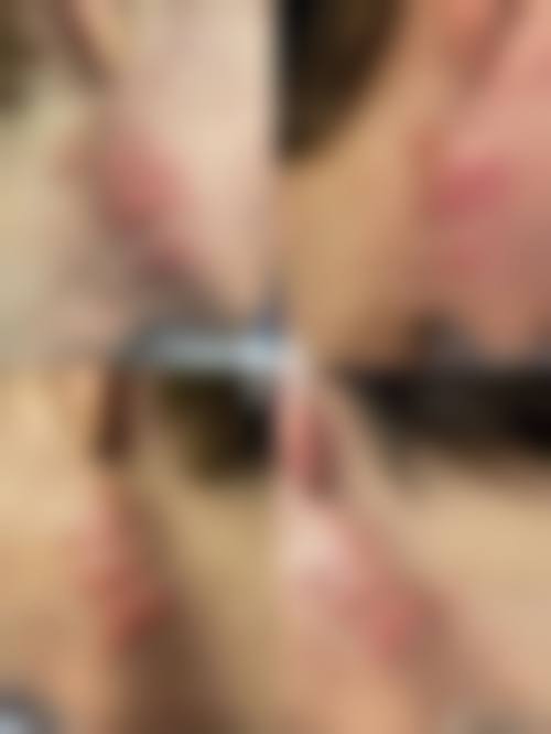 六、姚刚真实的患者评价