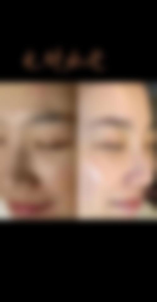 四、嘉兴悦程妇产医院医疗美容科特色项目