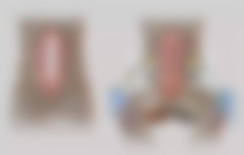 {硅胶隆鼻一定会挛缩吗？了解其出现挛缩的几率大小很重要！ 