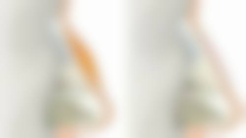 二、脸上疤痕增生的治疗方法