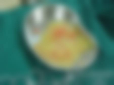 二、解放军81医院烧伤整形乳腺科怎么样?