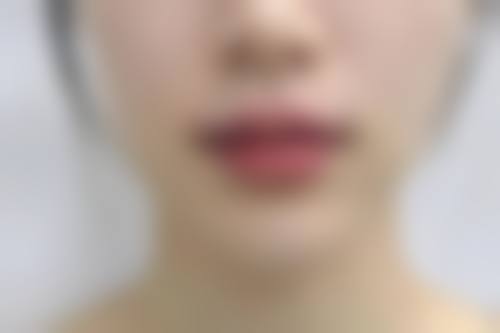 三、开封市第二人民医院医学美容科诊疗项目有哪些?