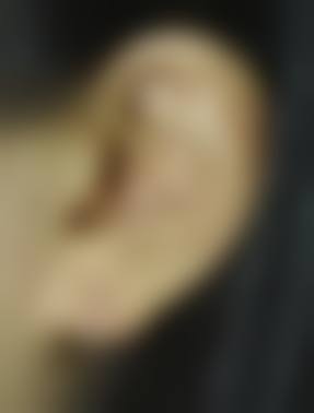 八、合肥至雅整形医院预约方式
