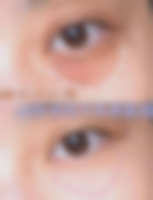 二、上饶希颜美医疗美容门诊部怎么样？