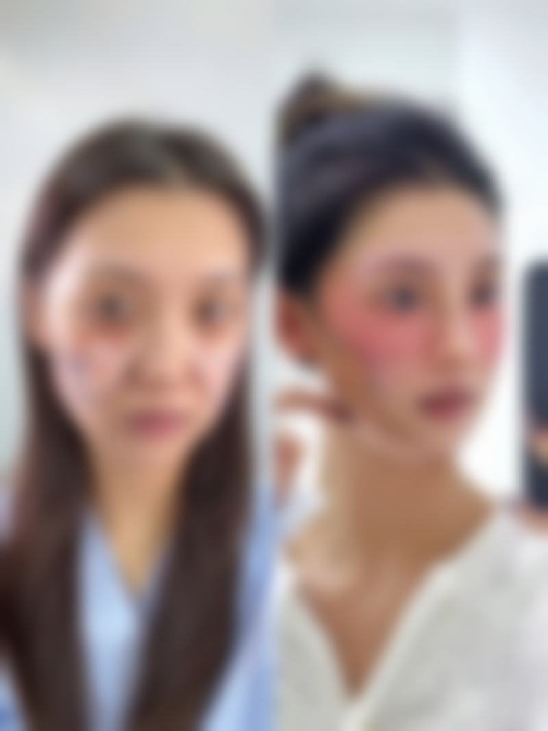 八、宜兴宇菲医疗美容诊所真实的患者评价