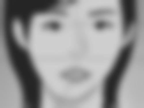 一、隆鼻硅胶膨体的材质特性对比