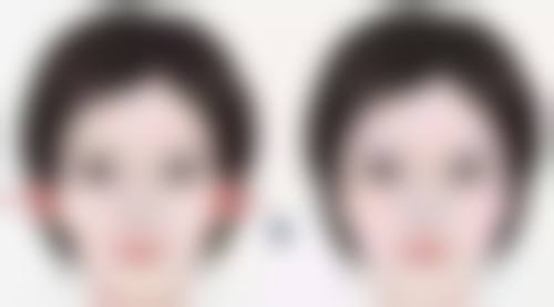 四、打瘦脸针的注意事项