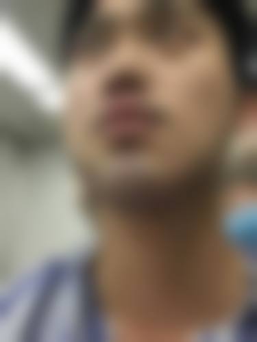 二、柳州新生天美植发怎么样?