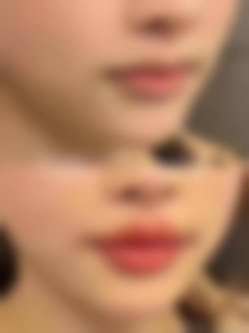 二、南宁伊美整形医院怎么样?