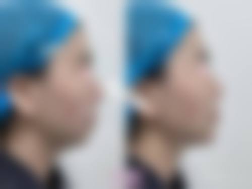 八、广西广丽医疗美容门诊部预约方式
