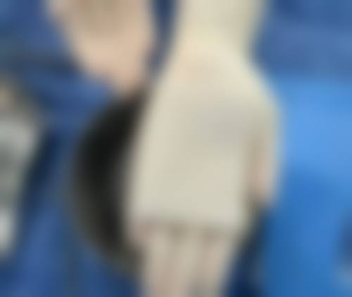 二、去眼袋的小窍门之饮食调理篇