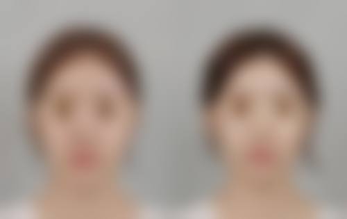 一、眼睛按摩仪的基本原理