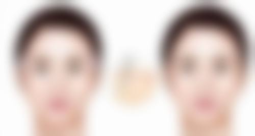 二、眼睛按摩仪对不同类型眼袋的影响
