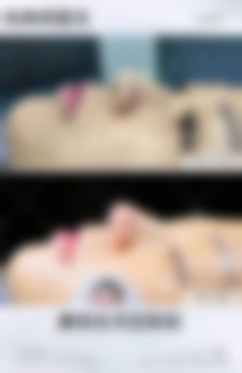 二、简阳直客医疗美容门诊怎么样?