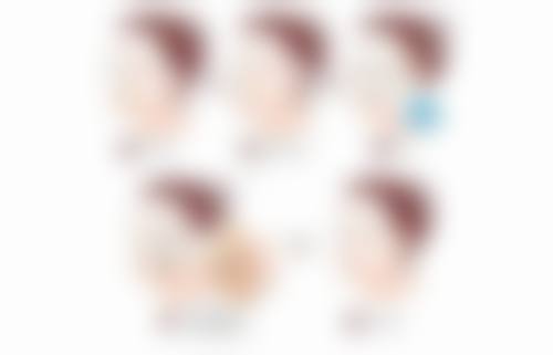 四、隆胸方式对比:硅胶假体与自体脂肪隆胸