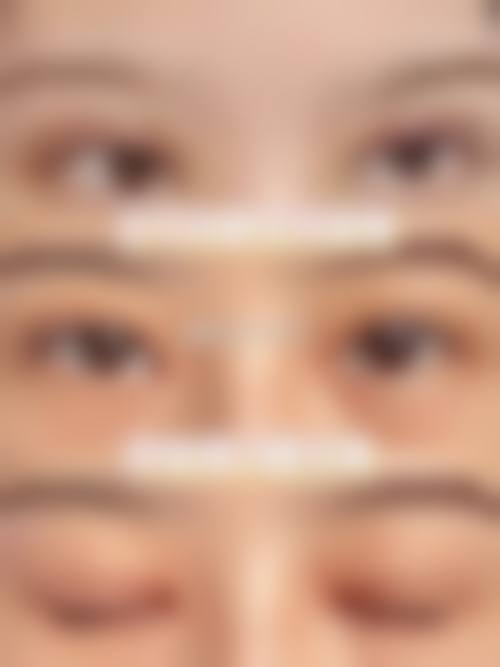 三、POP 整形外科诊疗项目有哪些?