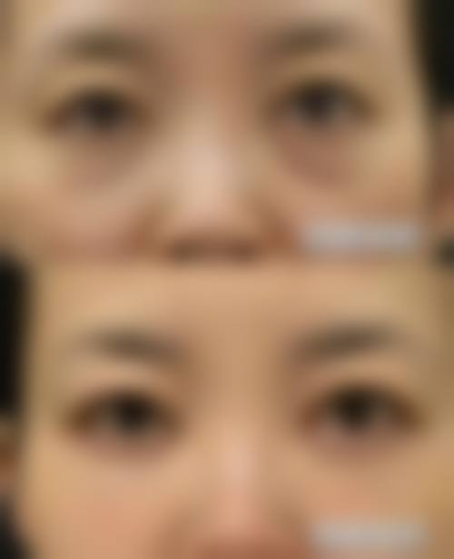 三、李荣雨技术优势