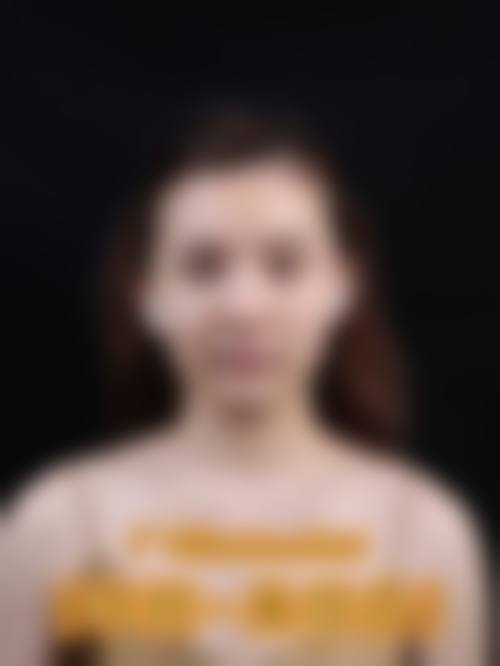 四、邵阳曹家整形美容特色项目