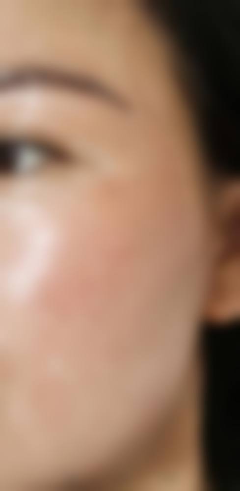 八、杭州菁华妇儿医院医疗美容科真实的患者评价