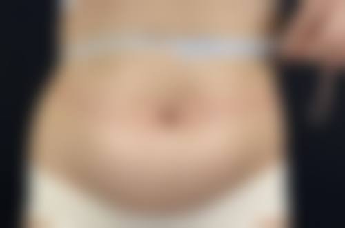九、柠悦美容整形真实的患者评价