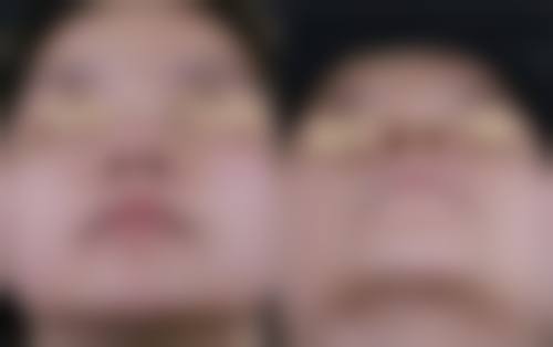 三、广州恒健医院植发中 心诊疗项目有哪些?