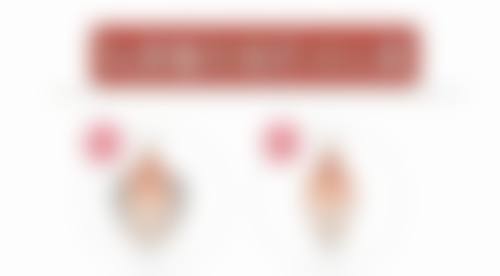 二、重睑修复术——调整双眼皮宽度