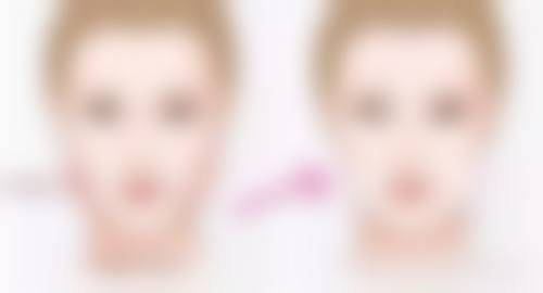 四、做隆胸手术是恒久的吗?个体差异对成效持久性的影响