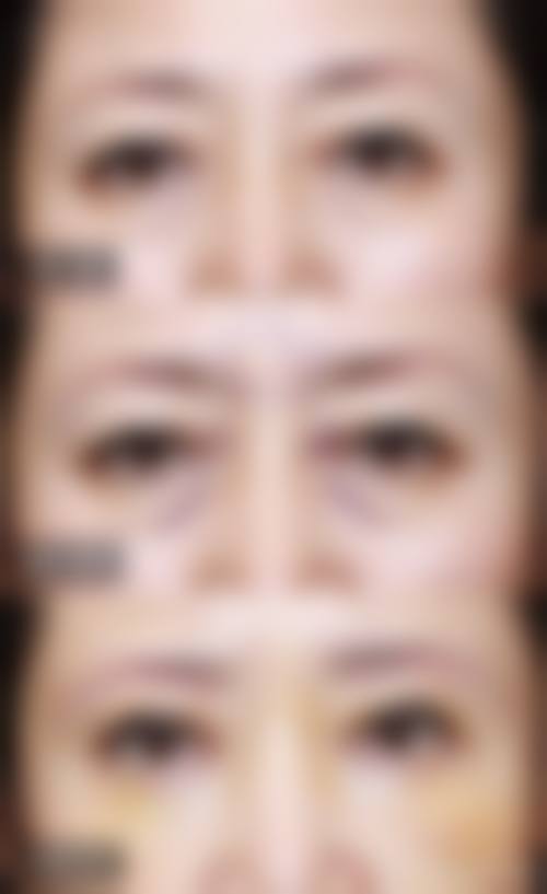三、林川元技术优势