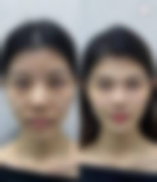 五、乌海悦己悦心医疗美容诊所价格表
