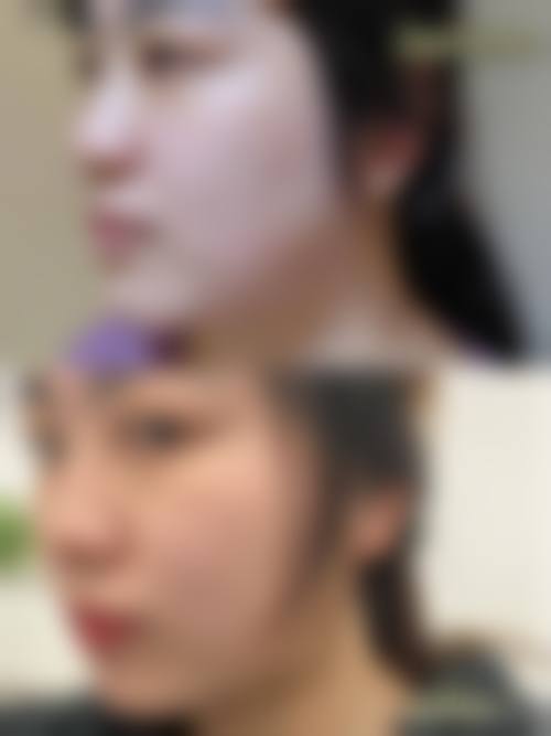 八、Ruby整形外科（如妃）真实的患者评价
