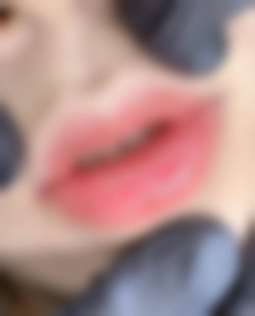 九、漯河缔莱美整形美容诊所真实的患者评价