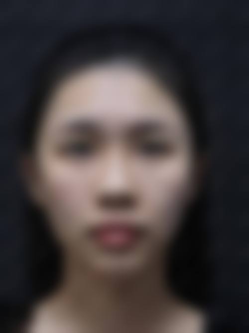 三、南京溯颜甄选医疗美容诊所诊疗项目有哪些?