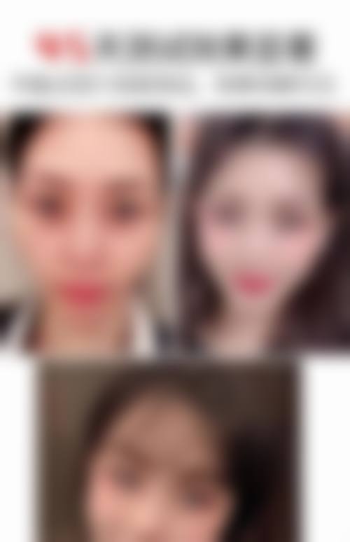 四、韩国丽姿女性激光整形医院特色项目