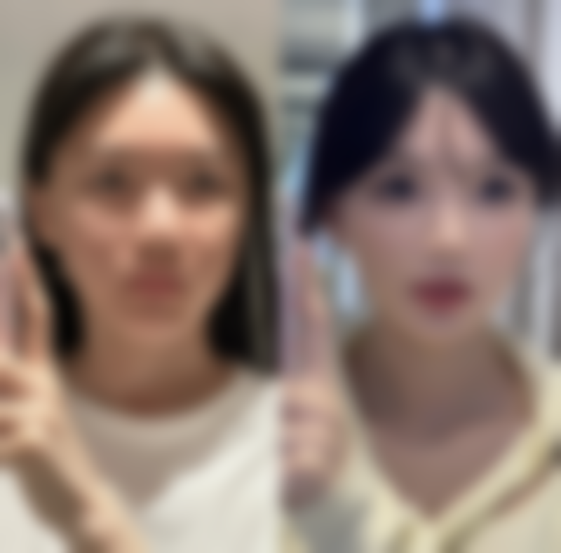 五、韩国丽姿女性激光整形医院价格表