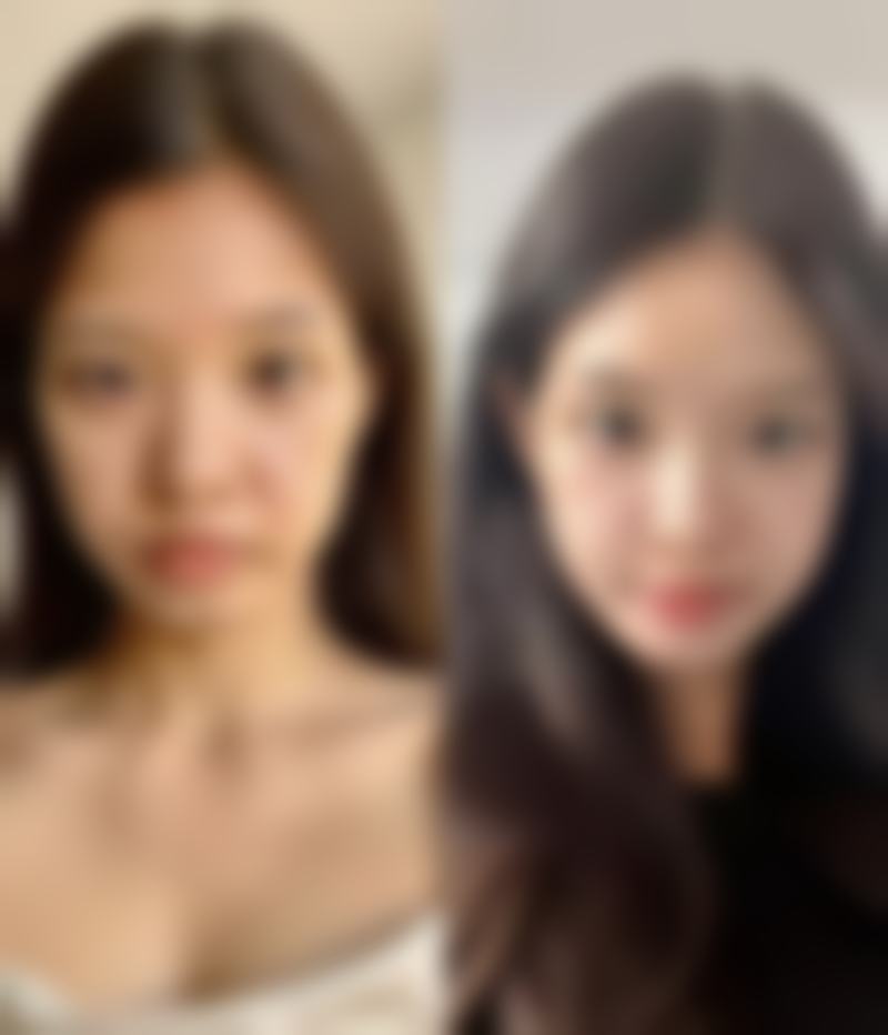 二、怎样才能睡成双眼皮:眼部护理的作用