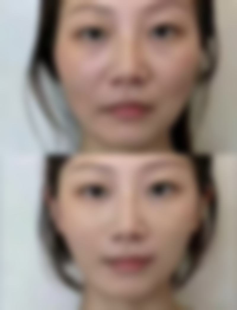 八、韩国丽姿女性激光整形医院真实的患者评价