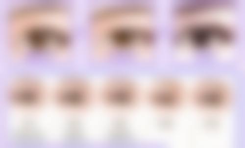 一、单眼皮和双眼皮哪个多一点之遗传因素