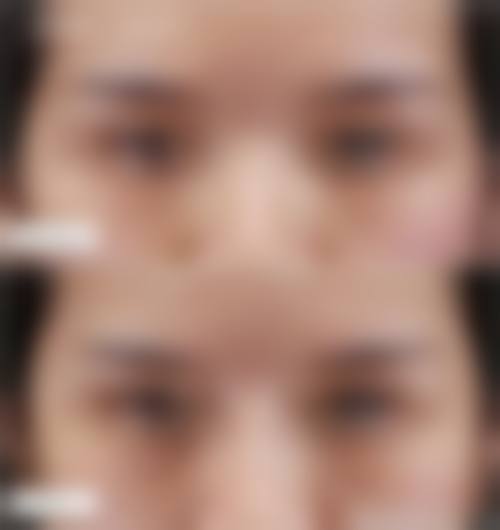三、广州植发医疗美容诊所诊疗项目有哪些？