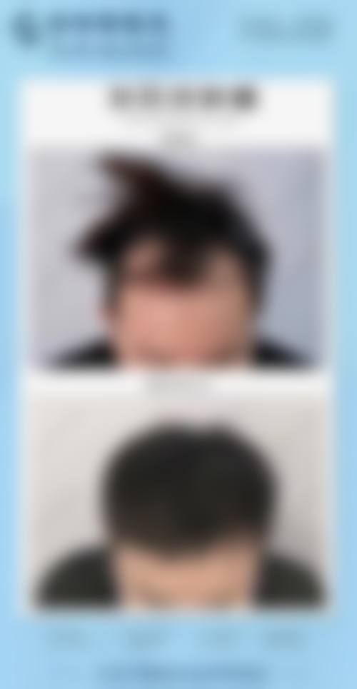 三、中山植德植发医疗美容门诊部诊疗项目有哪些?