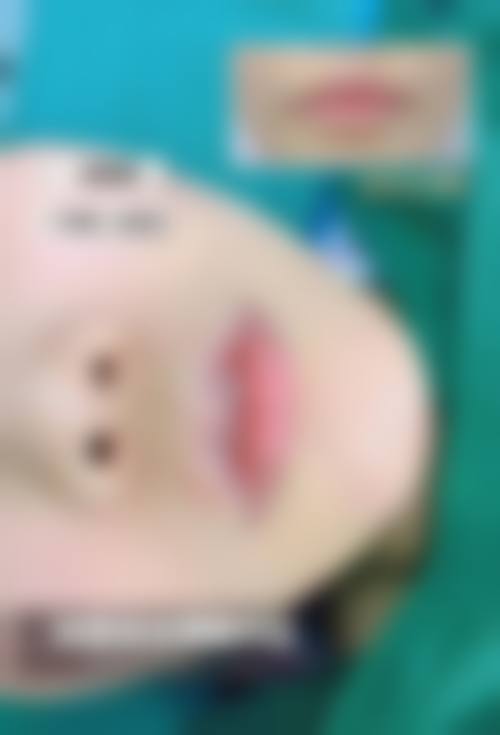 三、贵阳奥黛丽整形医院诊疗项目有哪些?