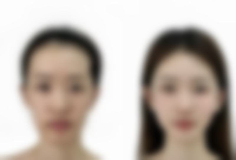 {单眼皮和双眼皮哪个多一点？从遗传和整形看现状，还探讨哪个更好看 