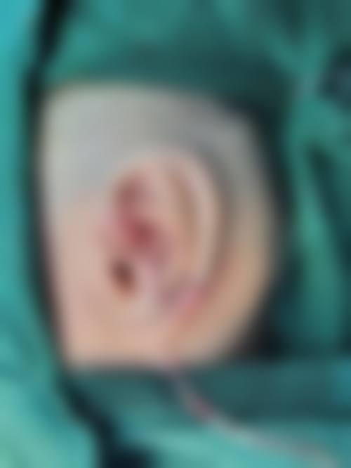 八、甬城妇科专科门诊部预约方式
